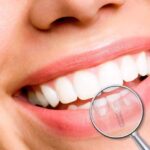 implante-dentario-clinica-w