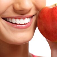 implantes-dentarios-clinica-w-df