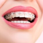 ortodontia-clinica-w