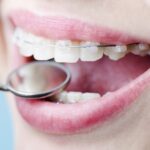 ortodontia-clinica-w-df